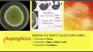 Yellow fungus  Aspergillus Flavus  Aspergillosis by Dr Marwah [upl. by Bernarr]