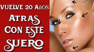 Suero Vitamínico Casero para rejuvenecer cualquier parte de tu piel [upl. by Satsoc]