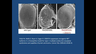 Surgery in the Care of Medullary Thyroid Cancer [upl. by Kesley733]