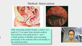 149 Is transurethral bladder outlet surgery useful for women with detrusor underactivity [upl. by Stent]