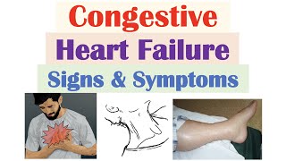 Congestive Heart Failure Signs amp Symptoms amp Why They Occur [upl. by Yrtneg]