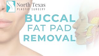 Buccal Fat Pad Removal [upl. by Coy]