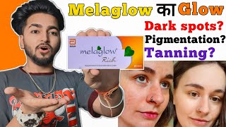 Does Melaglow Cream Really Works   Melaglow Rich Cream Review [upl. by Botnick916]