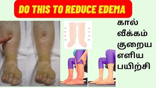 கால் வீக்கம் குறைய பயிற்சி  Edema Relief Exercise  பாத வீக்கம்  Tamil  DrShanmuga Pillai PT [upl. by Fauver771]