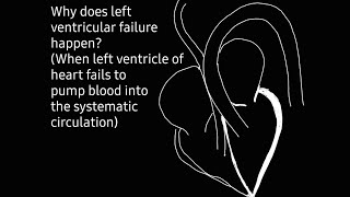 Cause of left ventricular failure [upl. by Nooj648]