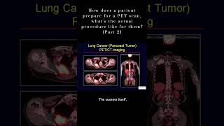 Pet Scan Procedure  Part 2  Shorts youtubeshorts [upl. by Airamesor606]