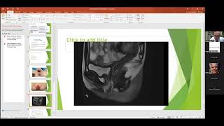 oct 2024 pleural effusion  accreta extramniotic pregnancy  andominal pregnancy best of isuog [upl. by Nodyarg]