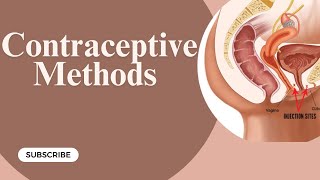 Contraceptive methods  Gynaecology Lecture  Part 11 [upl. by Arrad]