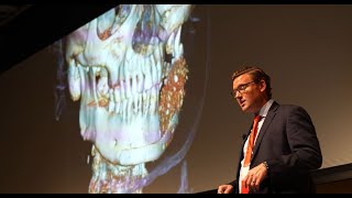 Dr Jeffrey Marschall on his use of ViviGen in complex CMF procedures [upl. by Naujd]