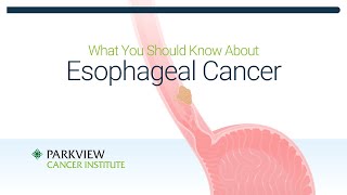 What You Should Know About Esophageal Cancer [upl. by Yessac]