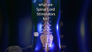 spinal cord stimulators what are they used for spine neuroscience minimallyinvasive [upl. by Almap]