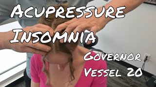 GV 20 Acupressure Insomnia [upl. by Porter]