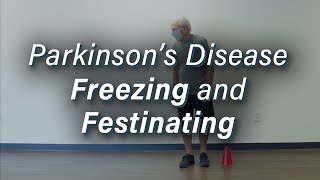 Parkinsons Disease Freezing amp Festinating Gait [upl. by Janet]