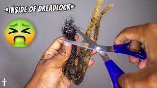 quotWhat Is Inside My 2 years of Dreadlocksquot MOLD  BUILDUPS [upl. by Lirrad143]