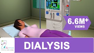 Procedure of DIALYSIS [upl. by Jemimah134]