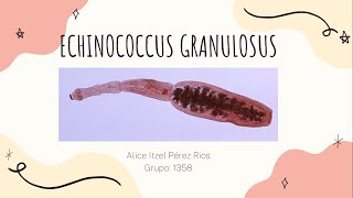 Echinococcus Granulosus Hidatidosis Unilocular [upl. by Ikim]