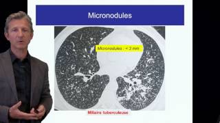 ECN PID cours 1 DFASM1 Diagnostic des PID Pr V Cottin Lyon [upl. by Annid]