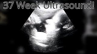 37 Week Ultrasound  How Big Is Baby [upl. by Nallak]