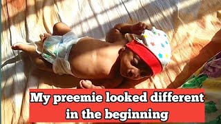 24 weeks micro preemie  First month at home  Premature baby care at home  Preterm Baby [upl. by Jamison]