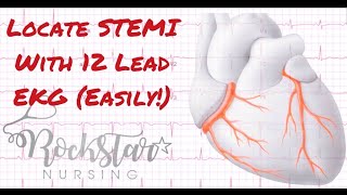 Locate and interpret STEMI based on 12 Lead EKG [upl. by Wilkison]