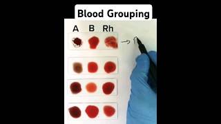 Blood Grouping made easy [upl. by Benil]