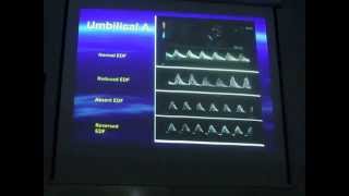 Fetal doppler  Dr Hussein Abo El Makarem [upl. by Bradleigh]