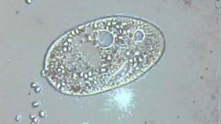 Egzocytoza  Exocytosis orzęsek [upl. by Egwin434]