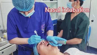 Nasotrachial intubation and Extubation a patient performed mandibular fixation [upl. by Ryter]