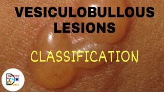 VESICULOBULLOUS LESIONS CLASSIFICATION [upl. by Evey]