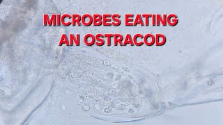 Various microbes eating the corpse of an ostracod  400x [upl. by Forrest52]