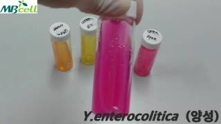 Urea Agar [upl. by Crompton]