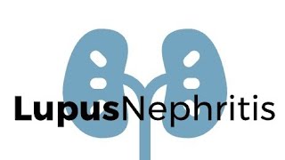 Lupus Nephritis 2024 Update Guidelines for Diagnosis and Management rheumatology sle 2024 [upl. by Joe628]