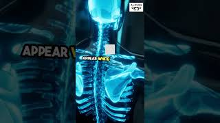 What Is an X Ray Machine  Intro to Biomedical Instrumentation Medical Imaging Device BioMedEng [upl. by Nima]