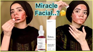 The Ordinary AHABHA Peeling Solution Review  Skin Care Product  Dietitian Aqsa [upl. by Glogau102]