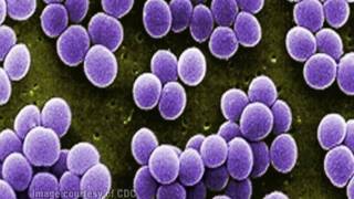 Staphylococcus aureus [upl. by Notluf]