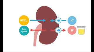 Treating acute salicylate toxicity [upl. by Moazami]