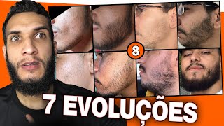 7 EVOLUÇÕES COM MINOXIDIL 8 [upl. by Alhahs]