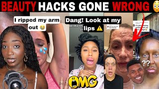 MERCY😱 BEAUTY HACKS GONE WRONG COSMETIC TRAUMA DIY BEAUTY FAILS  TIK TOK COMP [upl. by Neddie]