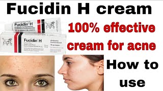 how to use fucidin H cream  for the acne treatment  complete review in urdu [upl. by Atwood]