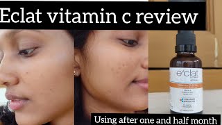 finally most requested review 😍☀️eclat vit C serum is this the magic potion 4 all your problemz🤔 [upl. by Rebe844]