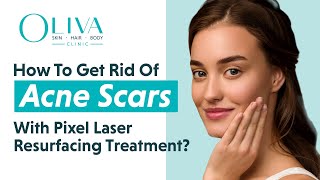 How To Get Rid Of Acne Scars With Pixel Laser Resurfacing Treatment Dr Rekha explains [upl. by Ahsienar]