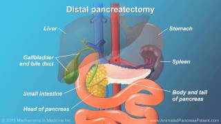 Pancreatic Surgery Benefits Risks and Relevant Anatomy [upl. by Riess]