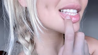 ¡SONRISA  DIENTES perfectos ✫ el mejor efecto brackets virtuales [upl. by Abrahamsen]