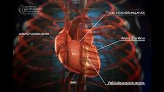 Angioplastia Coronária  Ultrassom  Hospital Cardiológico Costantini [upl. by Siva]