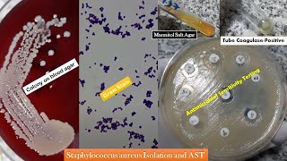 Staphylococcus aureus golden yellow colonies Gram stain Coagulase test Growth on MSA and AST [upl. by Questa812]