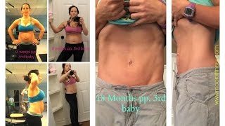 Your Guide to Treating Diastasis Recti PART 1 [upl. by Einahteb243]