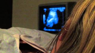 IVF diary  9  IVF the secret cycle  Embryo Transfer IVF [upl. by Zoila]