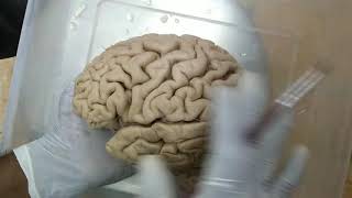 Cerebrum  specimen demo [upl. by Ynnav]