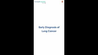 Early Diagnosis of Lung Cancer  Dr Vasunethra Kasargod  Manipal Hospital Millers Road [upl. by Repooc]