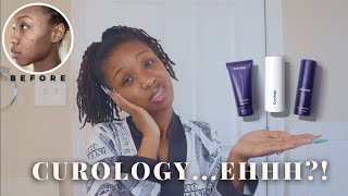 I Tried Curology For 30 Days amp This Happened Honest Review Hormonal Acne  Blemishes [upl. by Ahsiekin949]